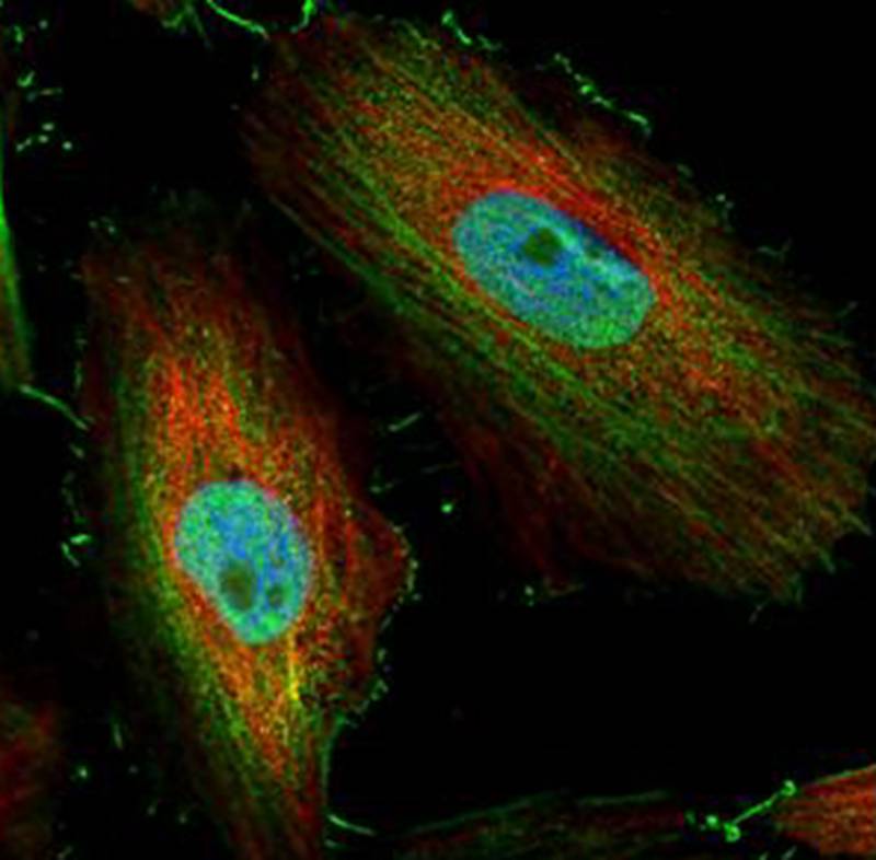 Anti-BIVM Antibody Anti-BIVM Antibody