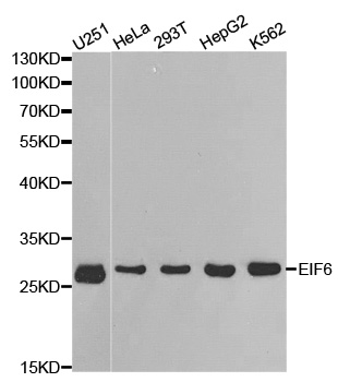 Anti-EIF6 Antibody