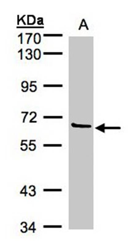 Anti-Factor XI Antibody