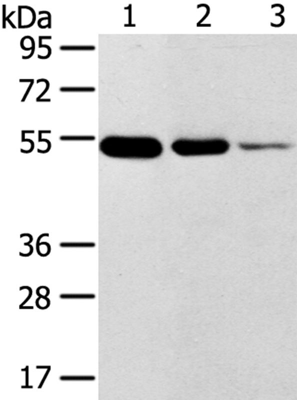 Anti-TMPRSS11F Antibody