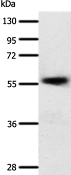 Anti-SLC22A17 Antibody