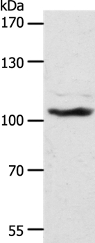 Anti-ADAMTS17 Antibody
