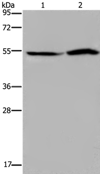 Anti-SLC22A12 Antibody