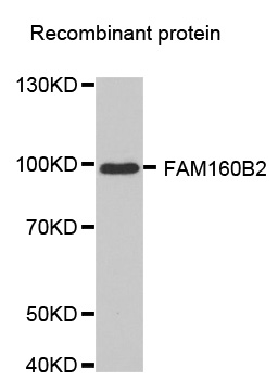 Anti-FAM160B2 Antibody
