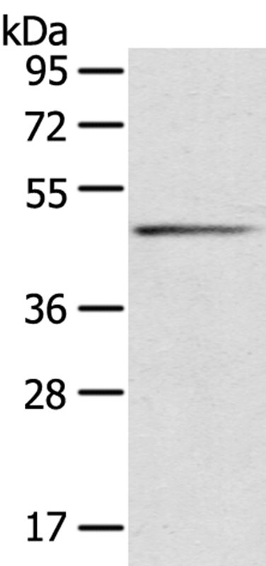 Anti-SERPINB8 Antibody