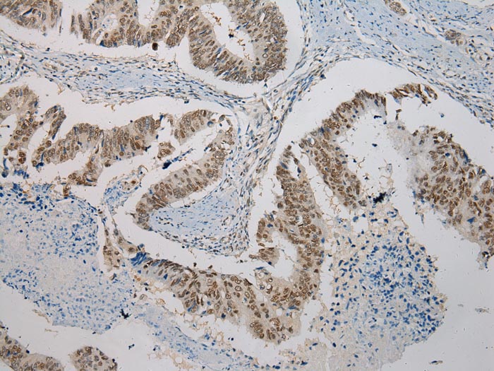 Anti-SERPINB8 Antibody Anti-SERPINB8 Antibody