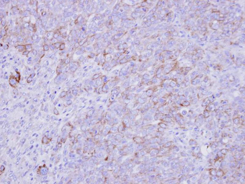 Anti-SLC26A8 Antibody Anti-SLC26A8 Antibody