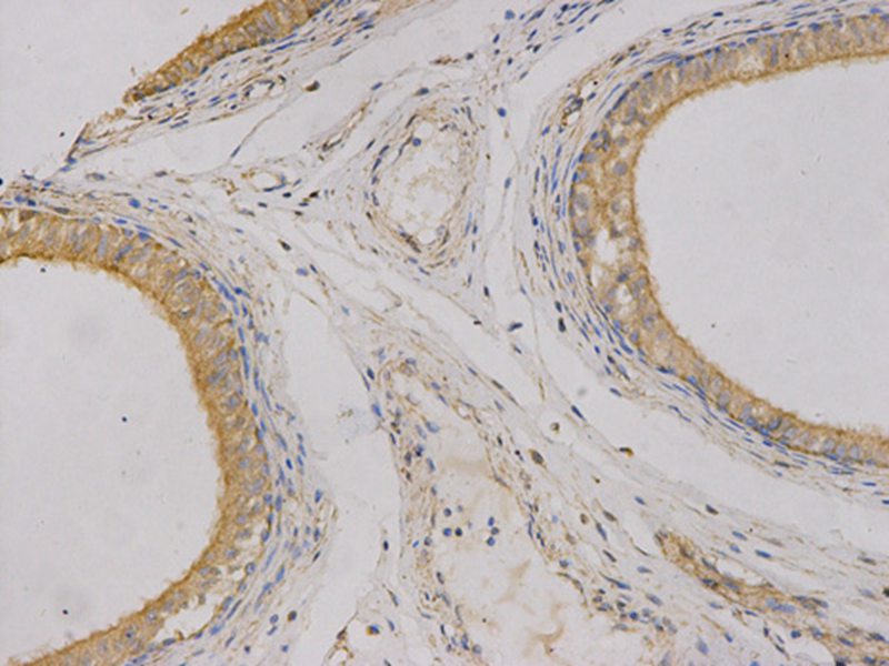 Anti-CEACAM3 Antibody Anti-CEACAM3 Antibody