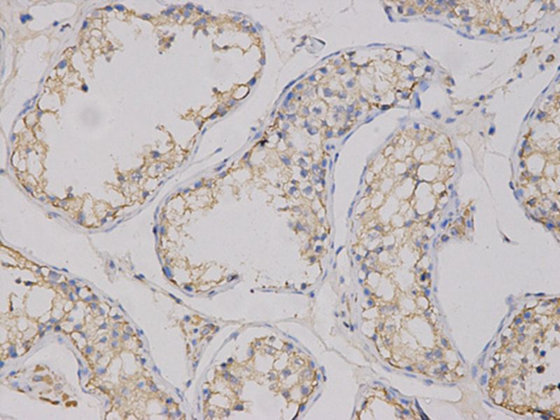 Anti-CEACAM3 Antibody Anti-CEACAM3 Antibody