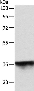 Anti-SPATA2L Antibody