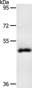 Anti-SPATA17 Antibody