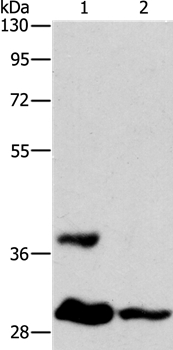 Anti-ANKRD54 Antibody