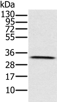 Anti-HSD17B8 Antibody
