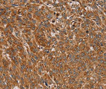 Anti-PLEKHG6 Antibody Anti-PLEKHG6 Antibody