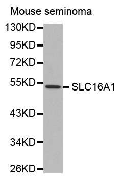 Anti-SLC16A1 Antibody