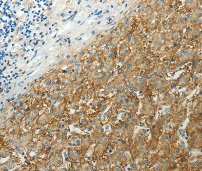 Anti-SLC16A1 Antibody Anti-SLC16A1 Antibody