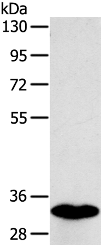 Anti-SULT1B1 Antibody