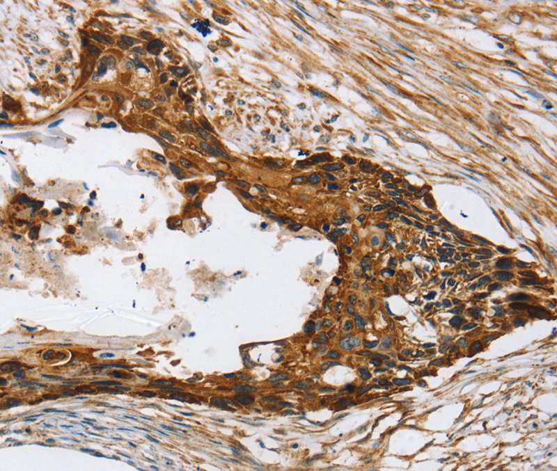 Anti-TPD52L2 Antibody Anti-TPD52L2 Antibody