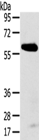 Anti-SPATA18 Antibody