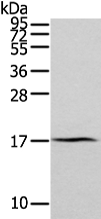 Anti-ZFAND2A Antibody