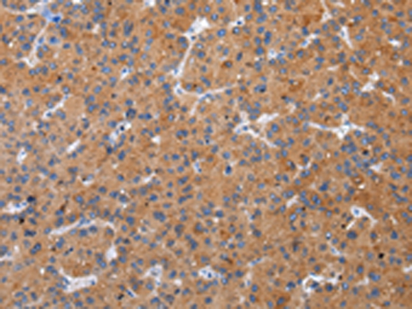 Anti-ZFAND2A Antibody Anti-ZFAND2A Antibody