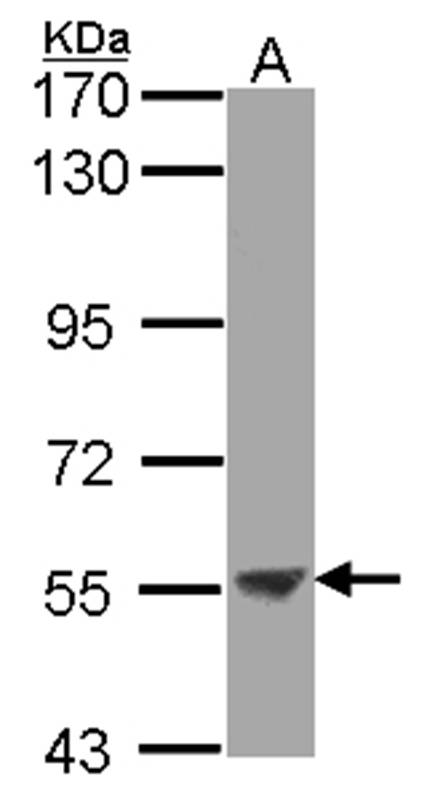 Anti-ENTPD3 Antibody