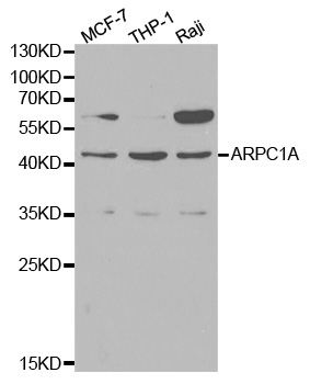 Anti-ARPC1A Antibody