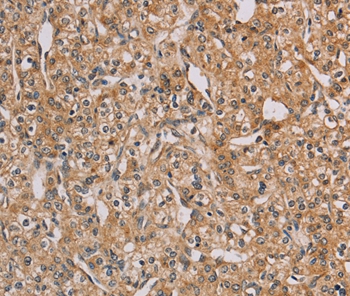 Anti-CHRNA4 Antibody Anti-CHRNA4 Antibody