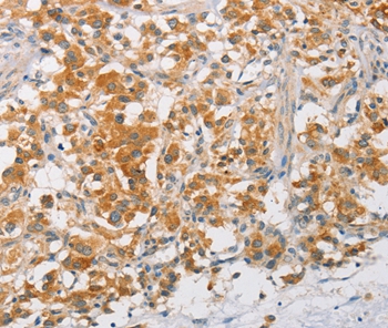 Anti-ARMCX3 Antibody Anti-ARMCX3 Antibody