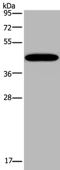 Anti-KCNK13 Antibody