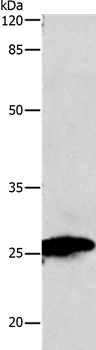 Anti-MT-CO2 Antibody