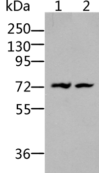 Anti-BDKRB2 Antibody