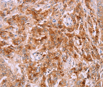 Anti-LPCAT4 Antibody Anti-LPCAT4 Antibody