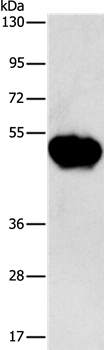 Anti-CHRDL2 Antibody