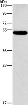 Anti-CALCRL Antibody