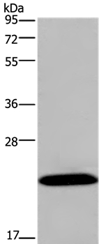 Anti-KCNMB4 Antibody