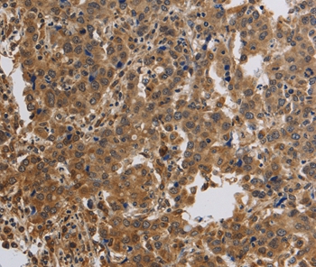 Anti-KCNMB4 Antibody Anti-KCNMB4 Antibody