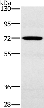 Anti-POU6F2 Antibody