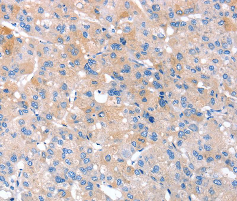 Anti-RNF214 Antibody Anti-RNF214 Antibody