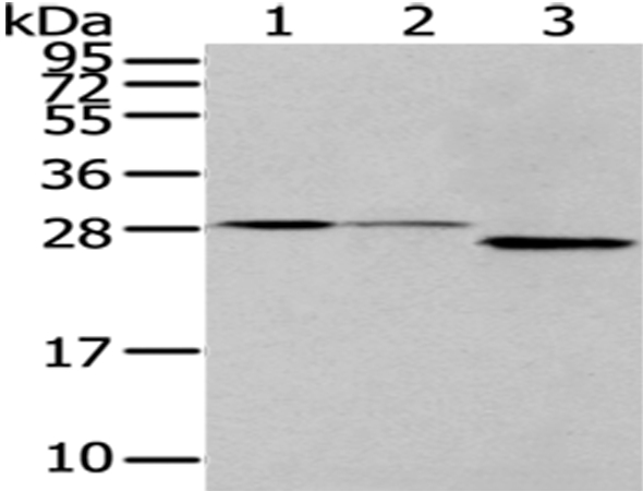 Anti-EEF1B2 Antibody