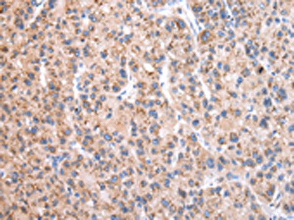 Anti-EEF1B2 Antibody Anti-EEF1B2 Antibody