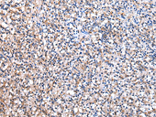 Anti-EEF1B2 Antibody Anti-EEF1B2 Antibody