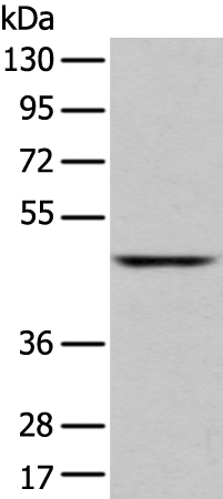 Anti-SLC2A6 Antibody
