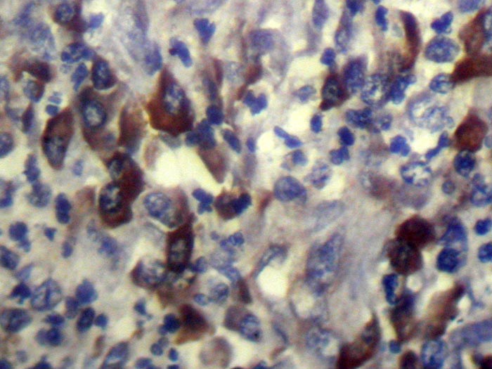 Anti-CARTPT Antibody