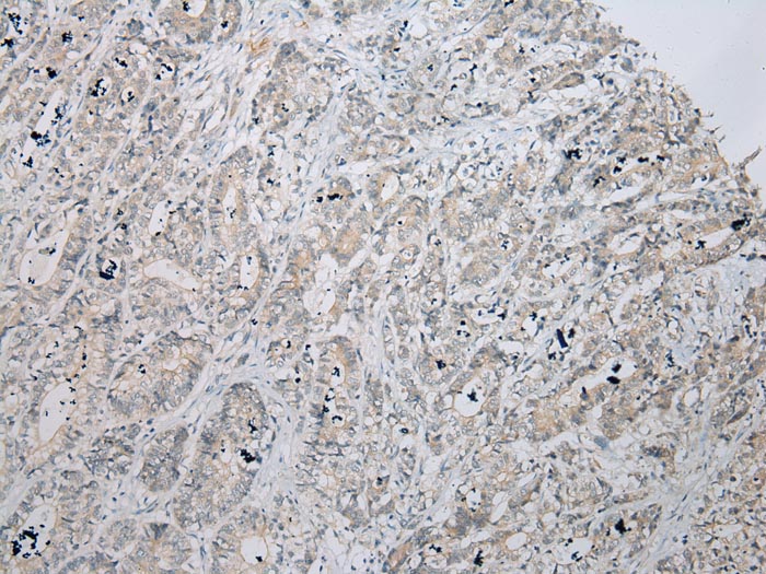 Anti-ZNF621 Antibody