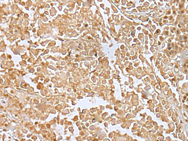 Anti-RILPL2 Antibody Anti-RILPL2 Antibody
