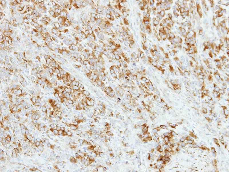 Anti-AP4M1 Antibody Anti-AP4M1 Antibody