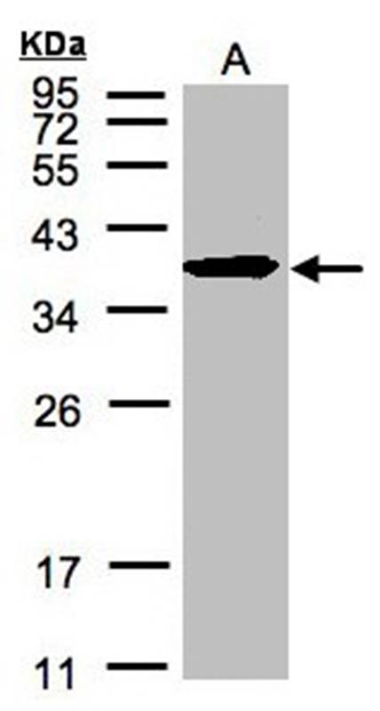 Anti-SPFH2 Antibody