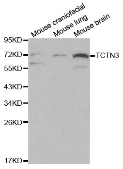 Anti-TCTN3 Antibody
