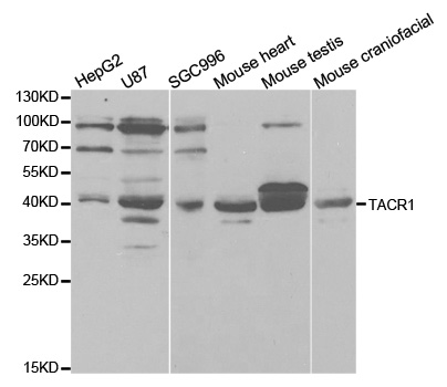 Anti-TACR1 Antibody